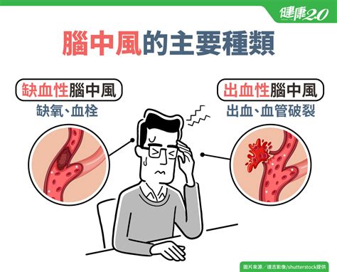 真杏通血路|缺血性腦中風 銀杏有助打通末梢血液循環